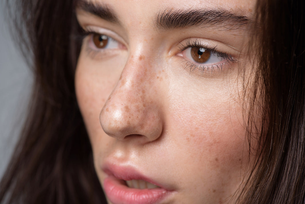 Suffer from sensitive skin? Learn more!